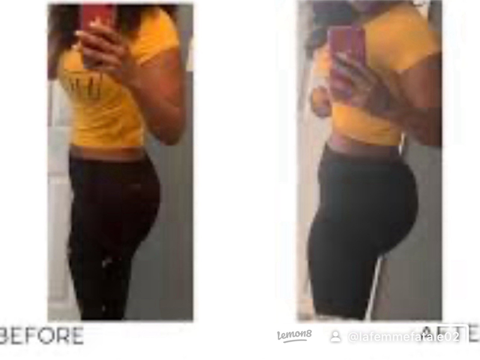 Rapid-Action BBL Syrup Butt Enlargement for Quick Growth – Lifting and Firming